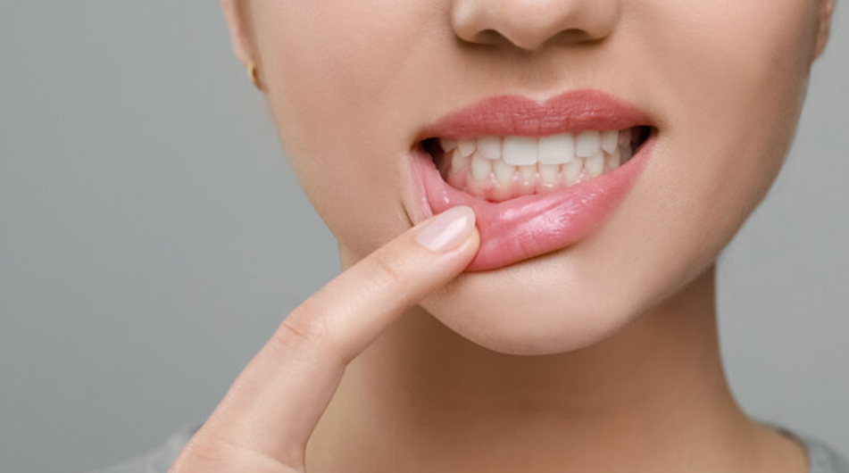 歯周病のイメージ