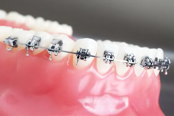 矯正歯科治療を提供