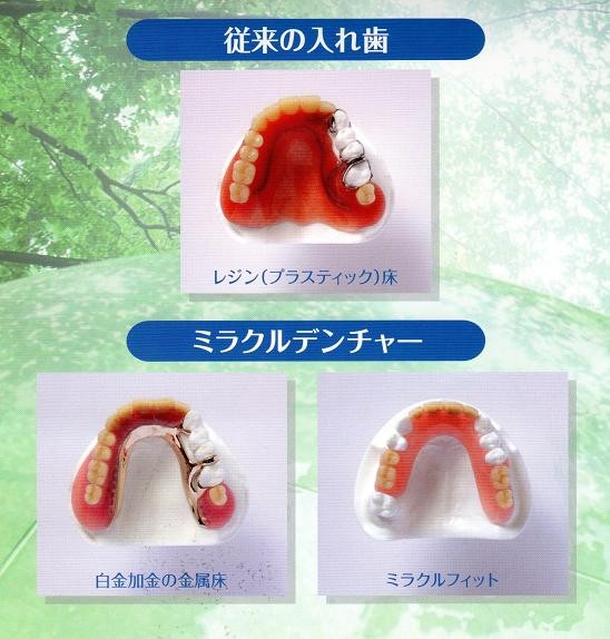ミラクルデンチャーを取り扱っています