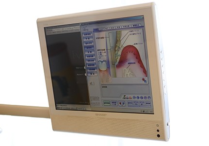 モニター設備によりわかりやすい説明を行っています