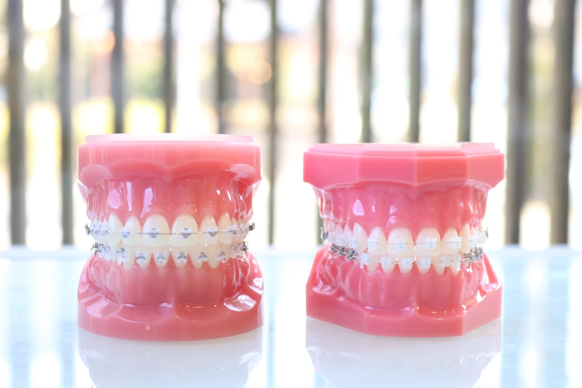 お子様から成人の患者様まで対応する矯正治療が行われています