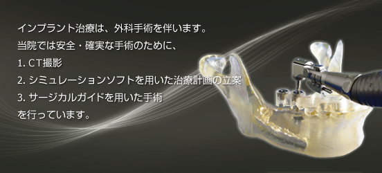 安全で信頼性の高いインプラント治療のために