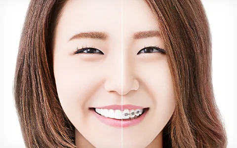 女性チームが支える快適なインビザライン治療