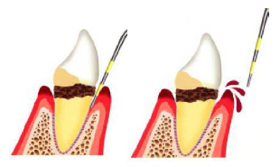 「小樽から虫歯と歯周病をなくそう」というスローガンを掲げ、地域の皆様の口腔健康を守るために歯周病治療に力を注いでいます