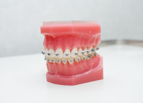 患者様が納得いくまで説明し、治療方針を決めるため、安心して治療を受けていただける環境を提供しています。