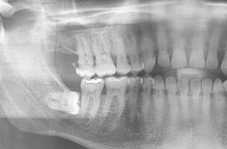 親知らずの抜歯から口腔がんスクリーニングまで安心の技術提供