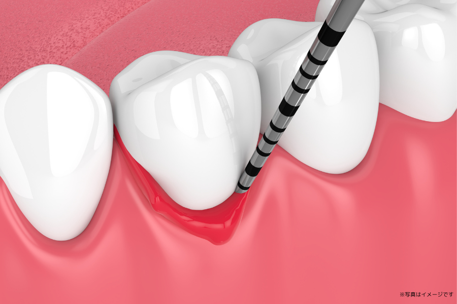 初期段階では自覚症状がほとんどないため、早期発見と治療が非常に重要です