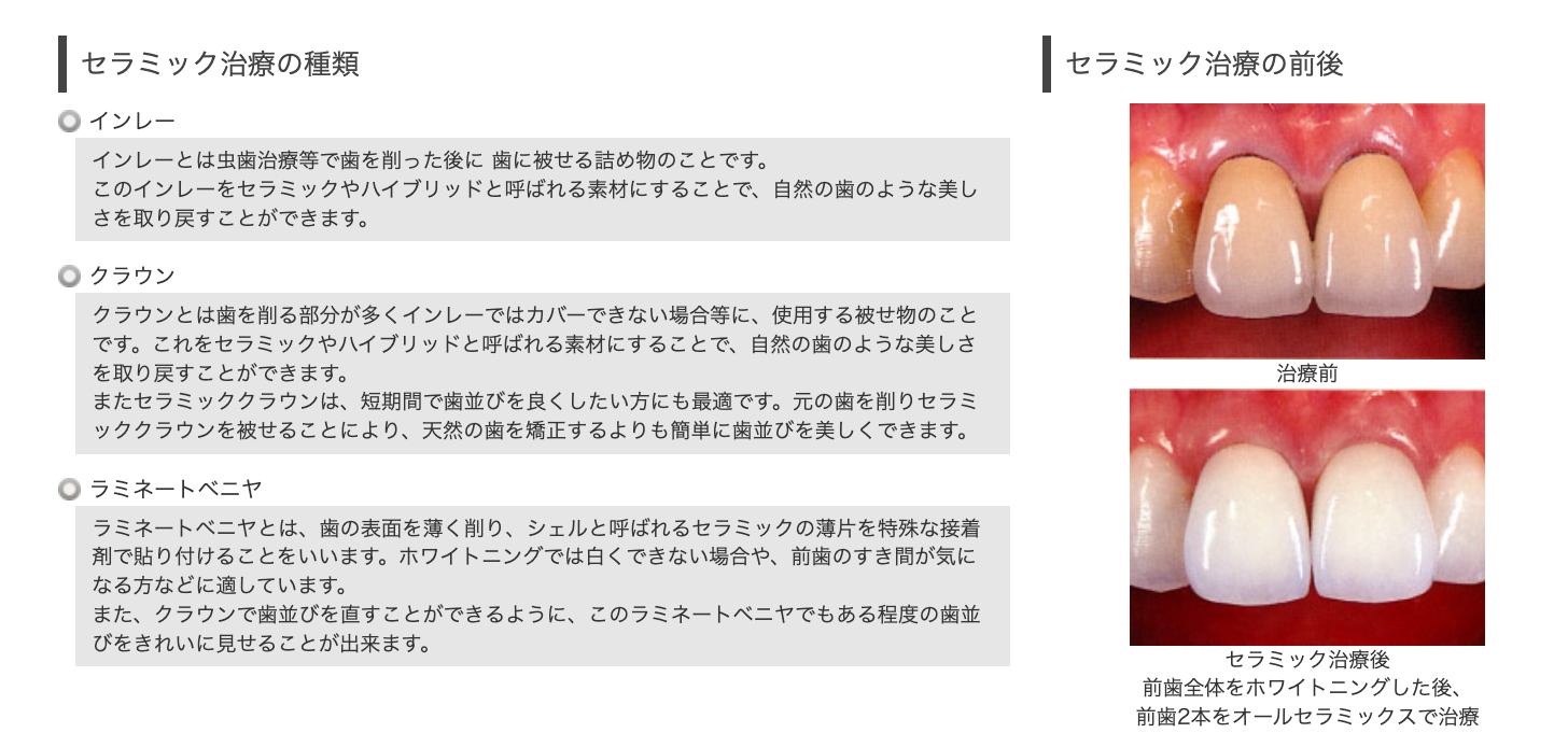 歯の色や形を整え、自然な美しさを引き出す治療を行います