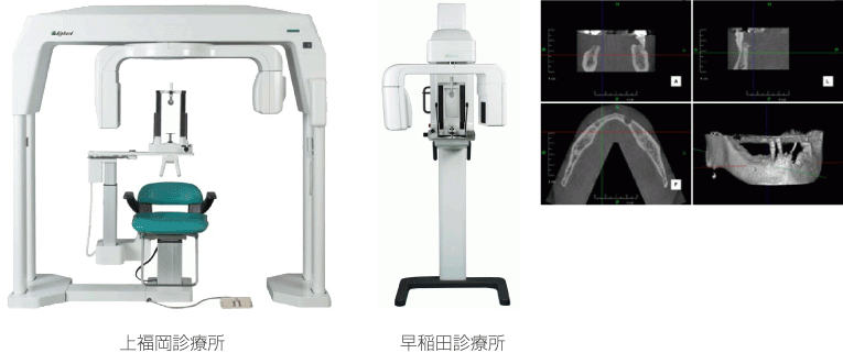 最新鋭の医療機器