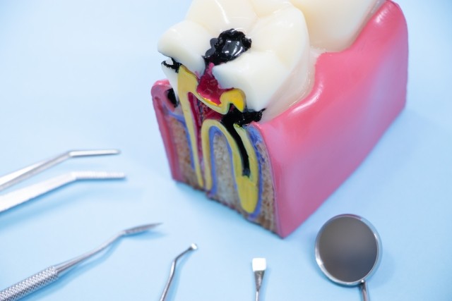 写真はイメージです