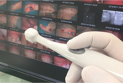 口腔内カメラにより患者様に治療の必要性をわかりやすく説明します