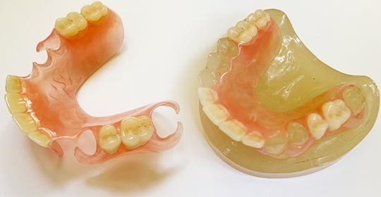 機能と審美の両立を重視した義歯設計を大切にしています。