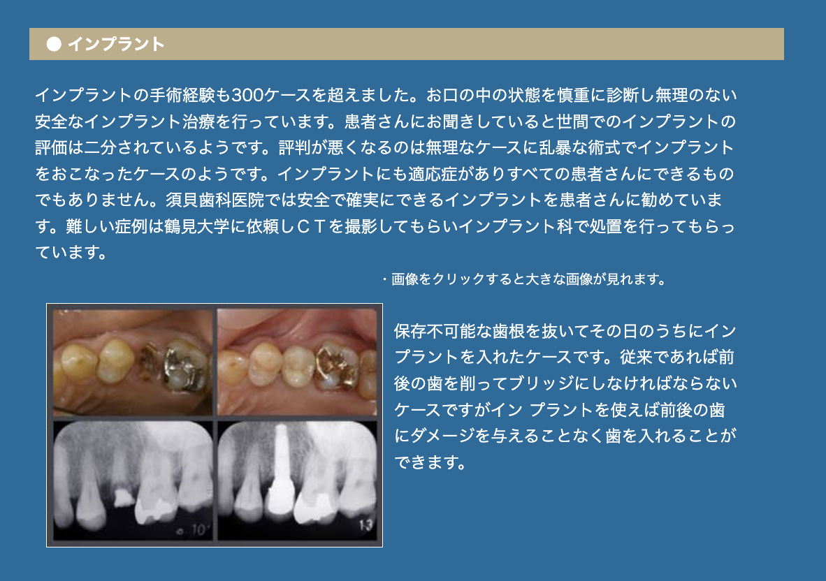須貝歯科医院ではこれまで300件以上の手術経験を基に、安全で無理のない治療を行っています