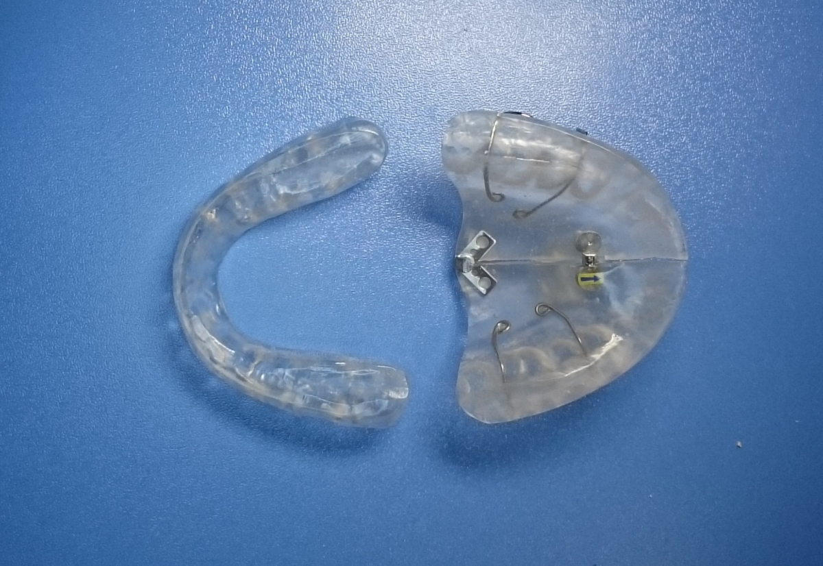 顎のずれを正しい位置に導きます