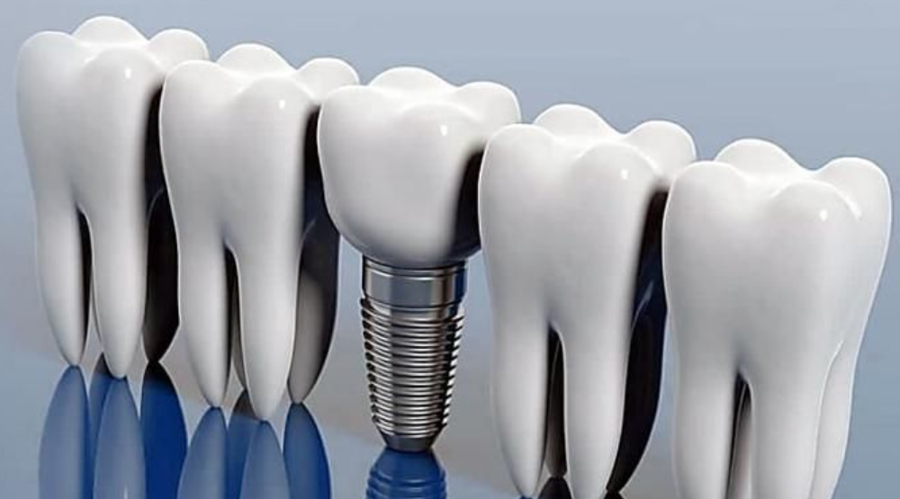 健康な歯に負担がかかりません