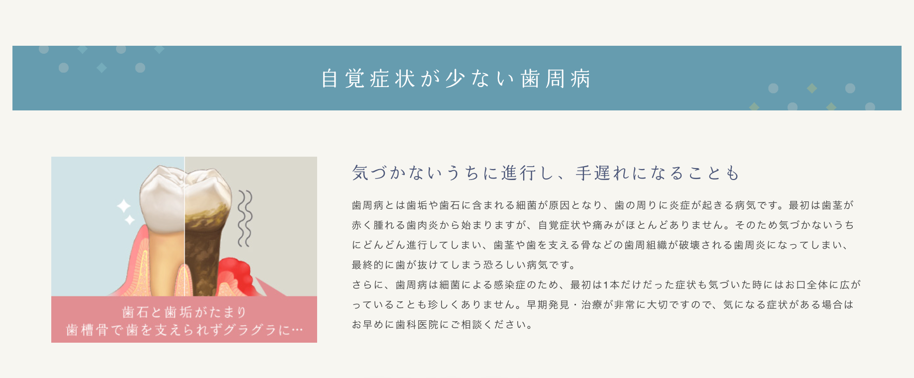 早期発見と適切な処置を重視し、歯を支える組織の健康を守るための歯周病治療を行っています