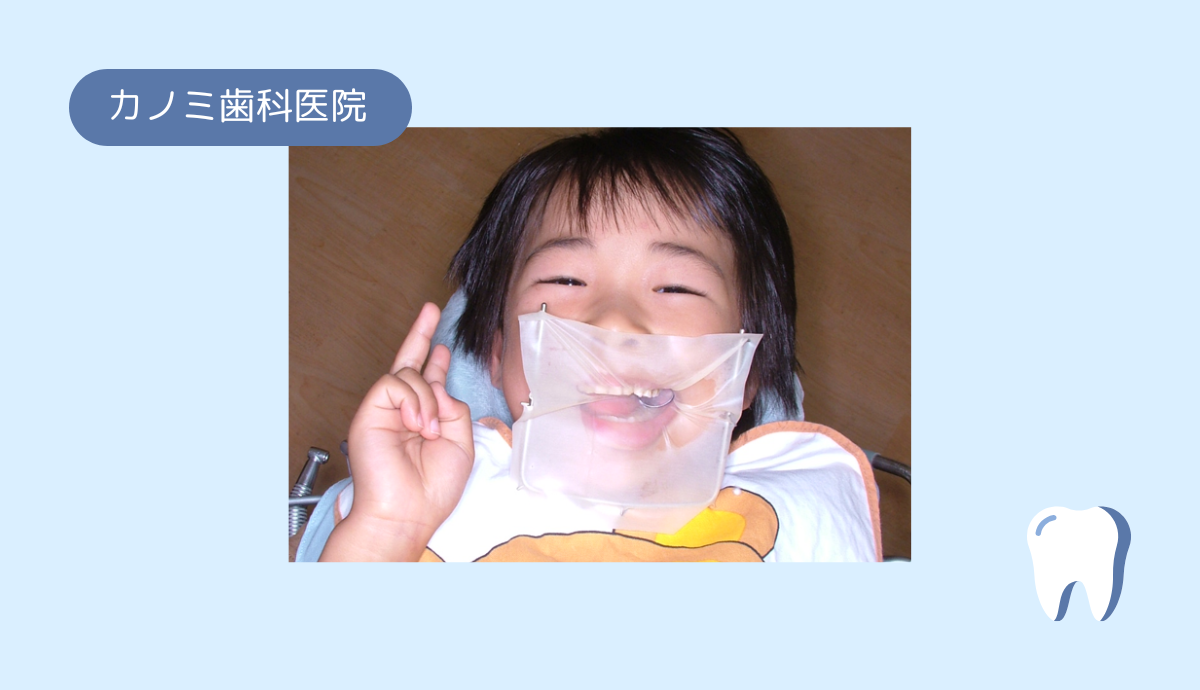 プロフェッショナルケアで虫歯・歯周病を徹底予防