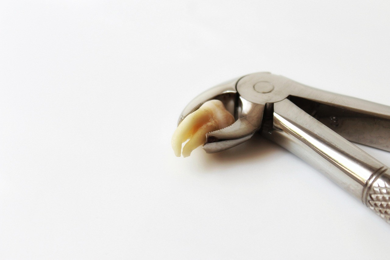 外科的処置を必要とするさまざまな口腔内トラブルに対応しています。※写真はイメージです。