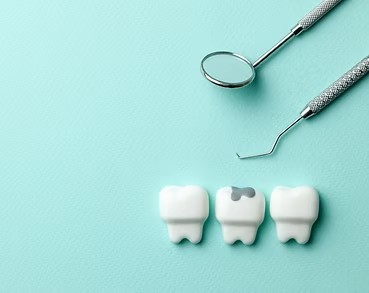治療後の予防ケアや定期検診にも力を入れ、お口の健康維持をサポートしています。