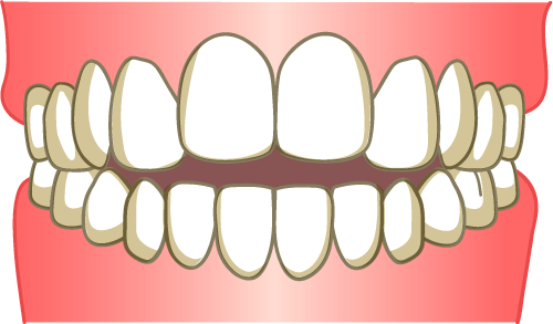 成長期のお子様に正しい噛み合わせを