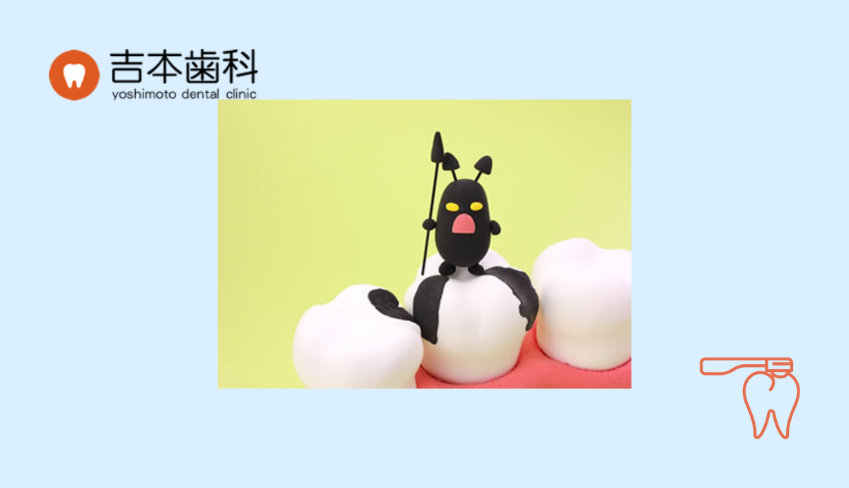 PMTCとセルフケア指導で支える予防歯科