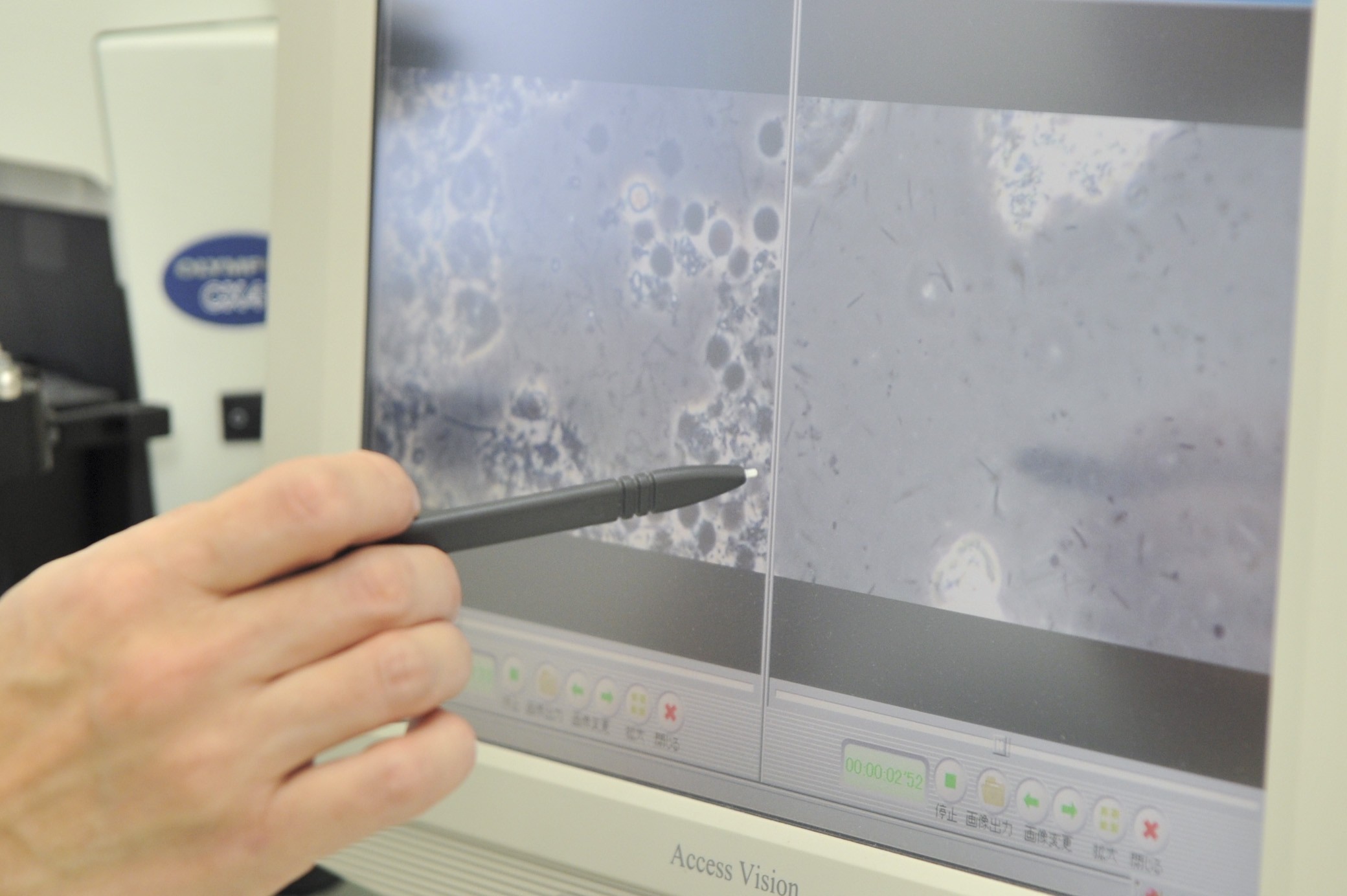 早めの受診をおすすめします