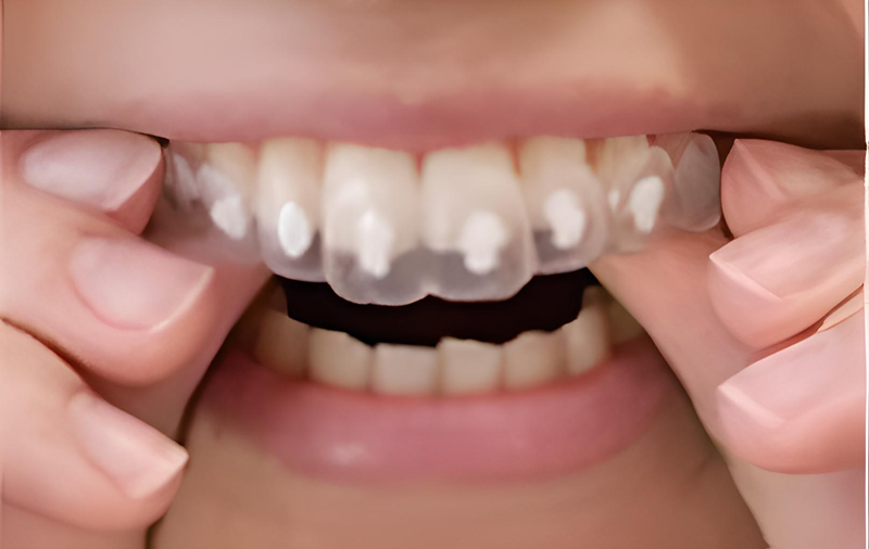 日本矯正歯科学会認定医による小児から成人まで対応の矯正治療