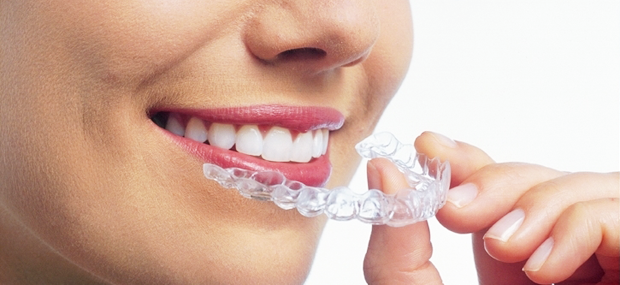 マウスピースを用いた矯正治療を提供しています