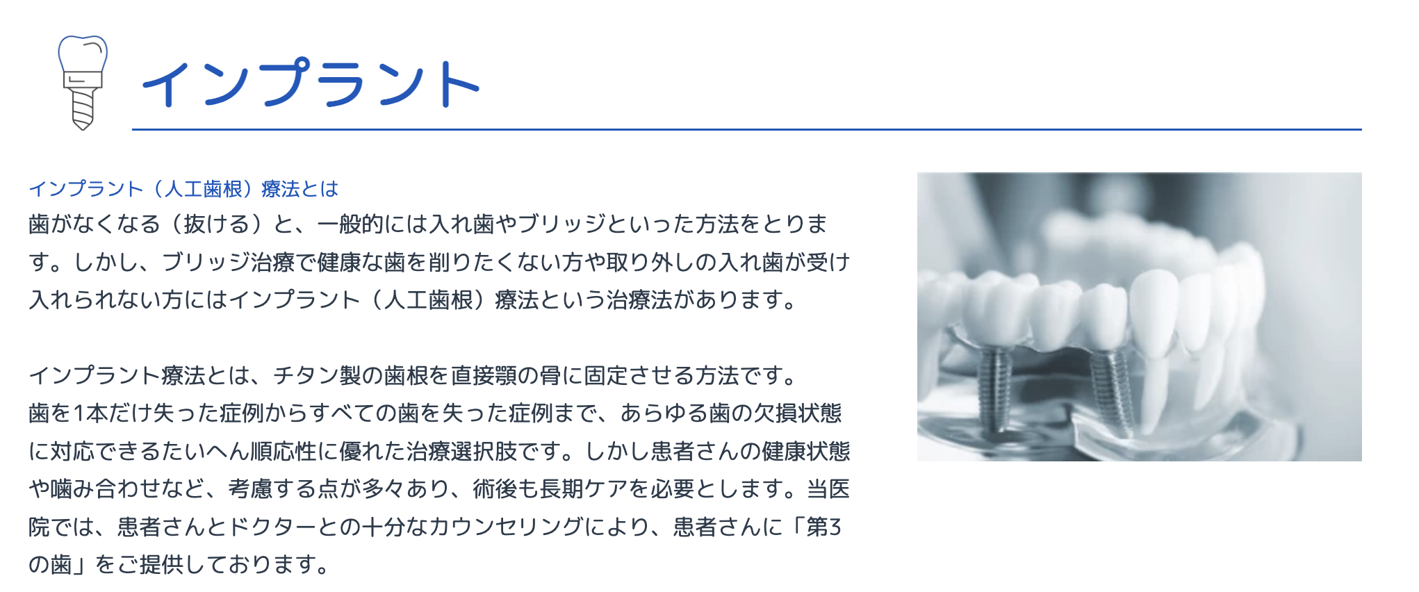インプラント治療を通じて、自然な噛み心地と美しい口元を取り戻すお手伝いをしています