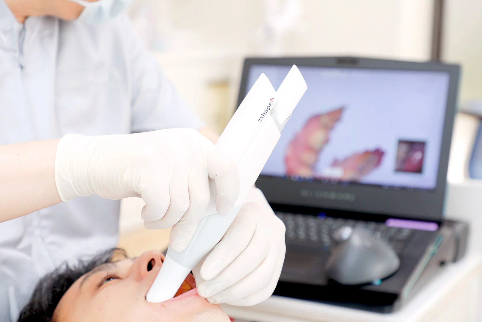 歯をなるべく削らず、美しさと機能を両立した補綴治療