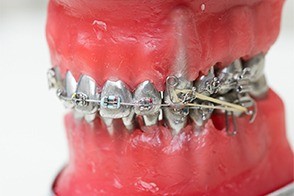 見た目の整いと将来の予防効果を両立し、長期的な口腔健康の維持を支えています。