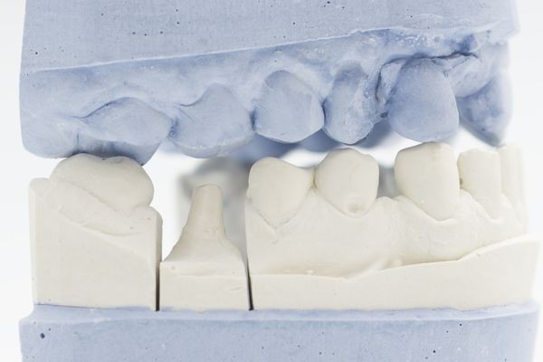 ※画像はイメージです