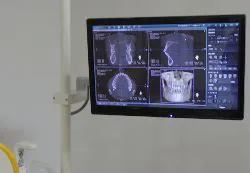 デジタル機器と丁寧な検査で、歯周病の進行を防止