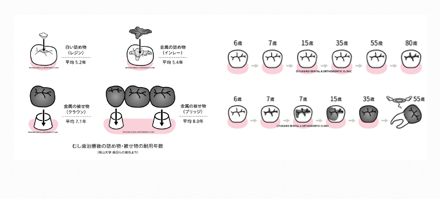 患者様の口腔内の健康を長期的に維持するための診療を行っています