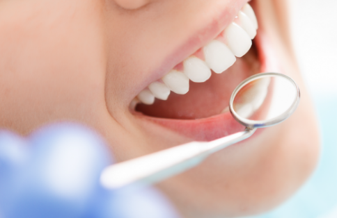 歯茎の腫れや出血は要注意