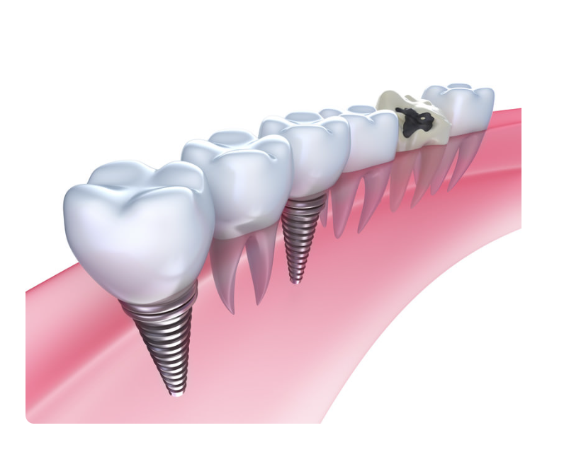 不安や疑問にも丁寧に対応し、安心して治療を受けられる環境を整えています