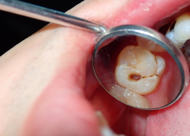 早めの受診をおすすめします