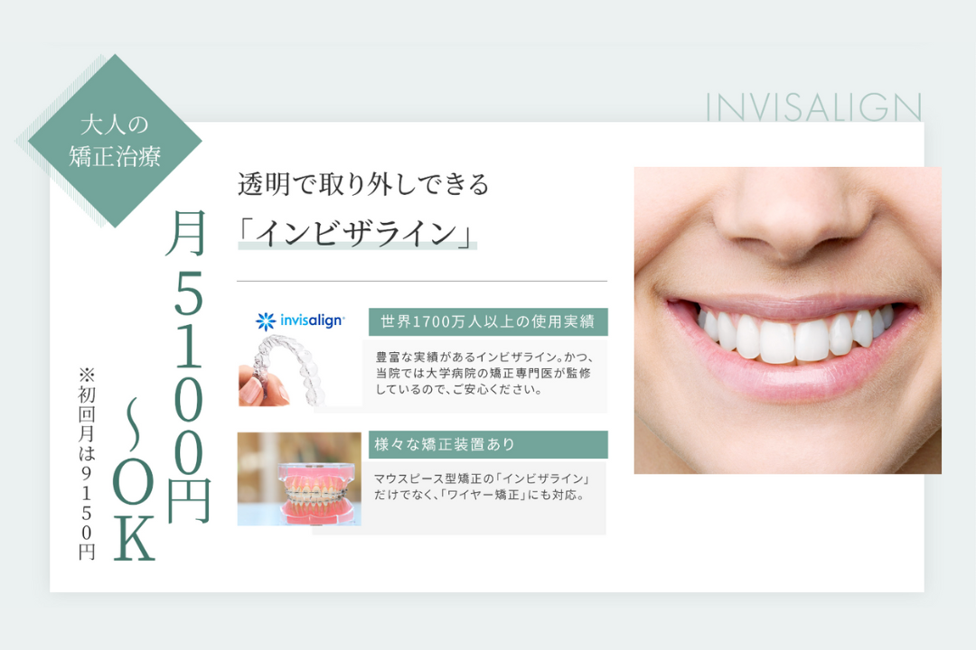 成人矯正治療の特徴