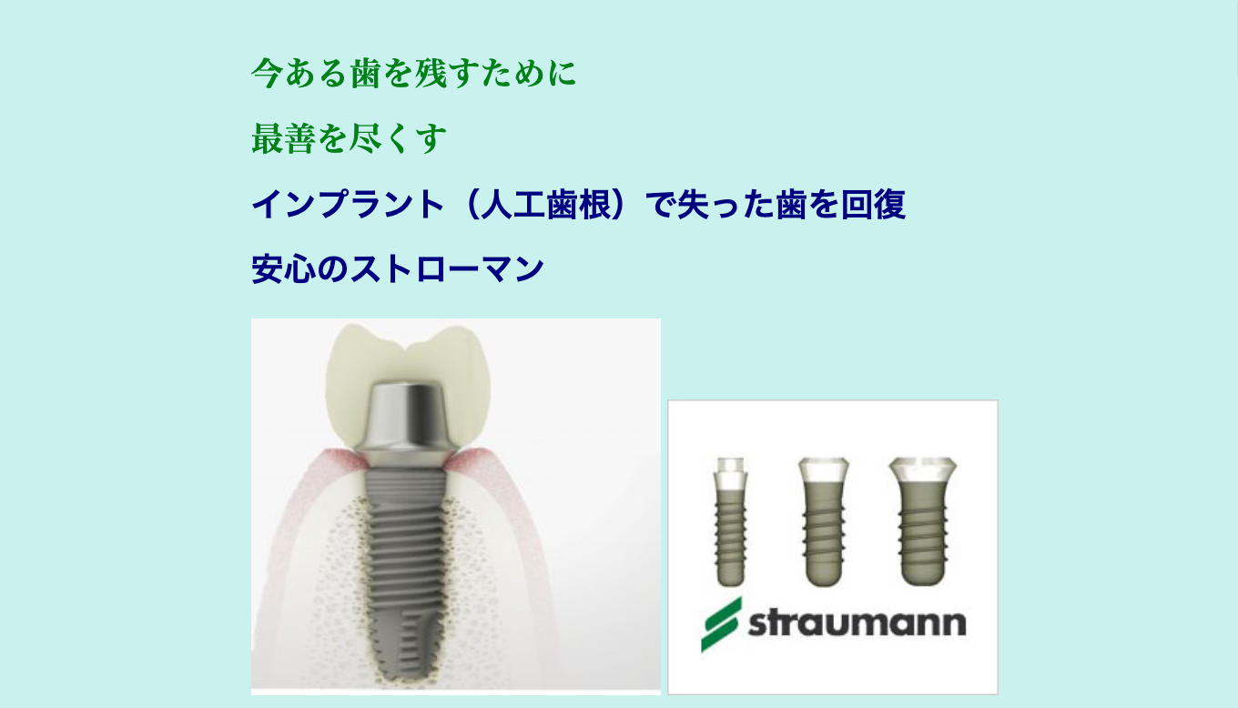 失った歯を補う治療法として、インプラントとブリッジの2つの選択肢があります