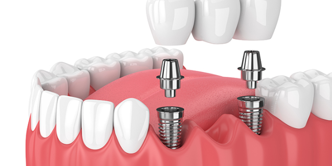 安全第一の治療を施します