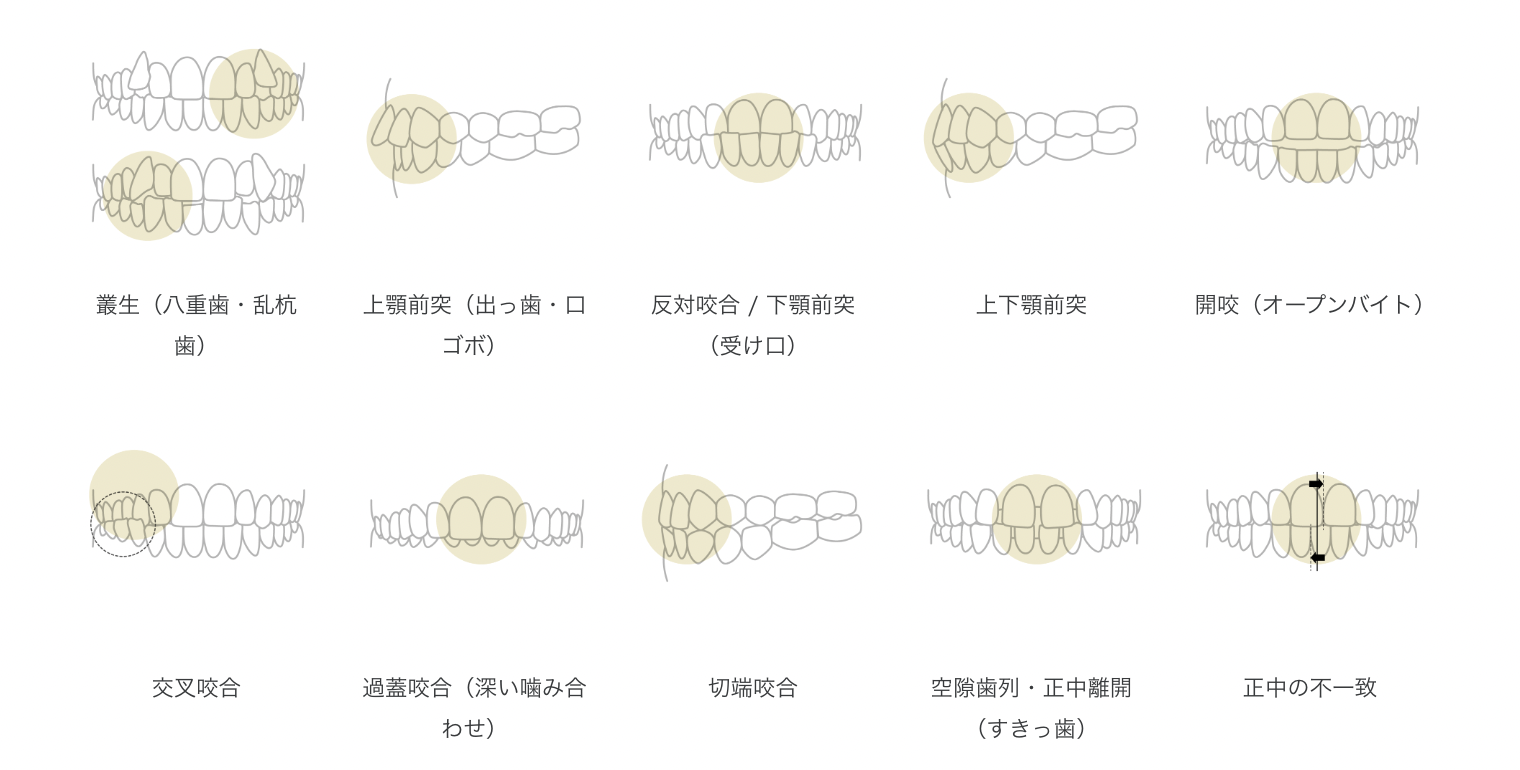 女性のインビザライン・ドクターによる治療