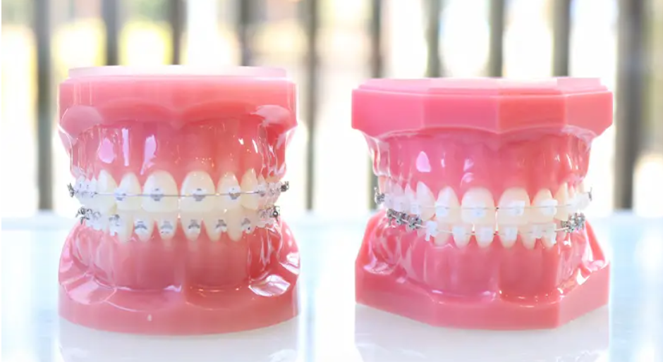 歯並びが気になる方はぜひ一度ご相談ください