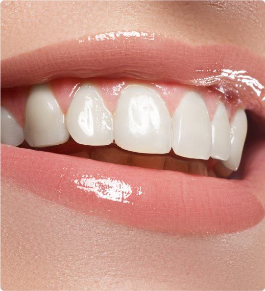 患者様一人一人のニーズに合わせたオールセラミック治療を提供しています