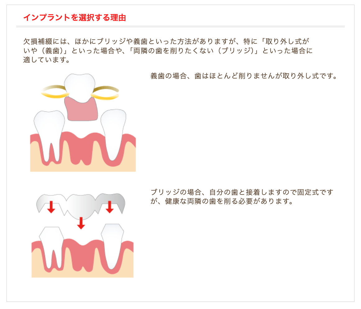 インプラント治療を通じて患者様の健康的な噛み心地と生活の質を取り戻すサポートをしています