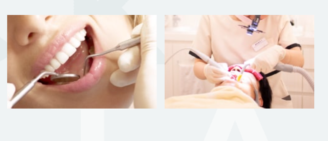 歯周病予防のために、歯科医院で行うケアはとても大切です