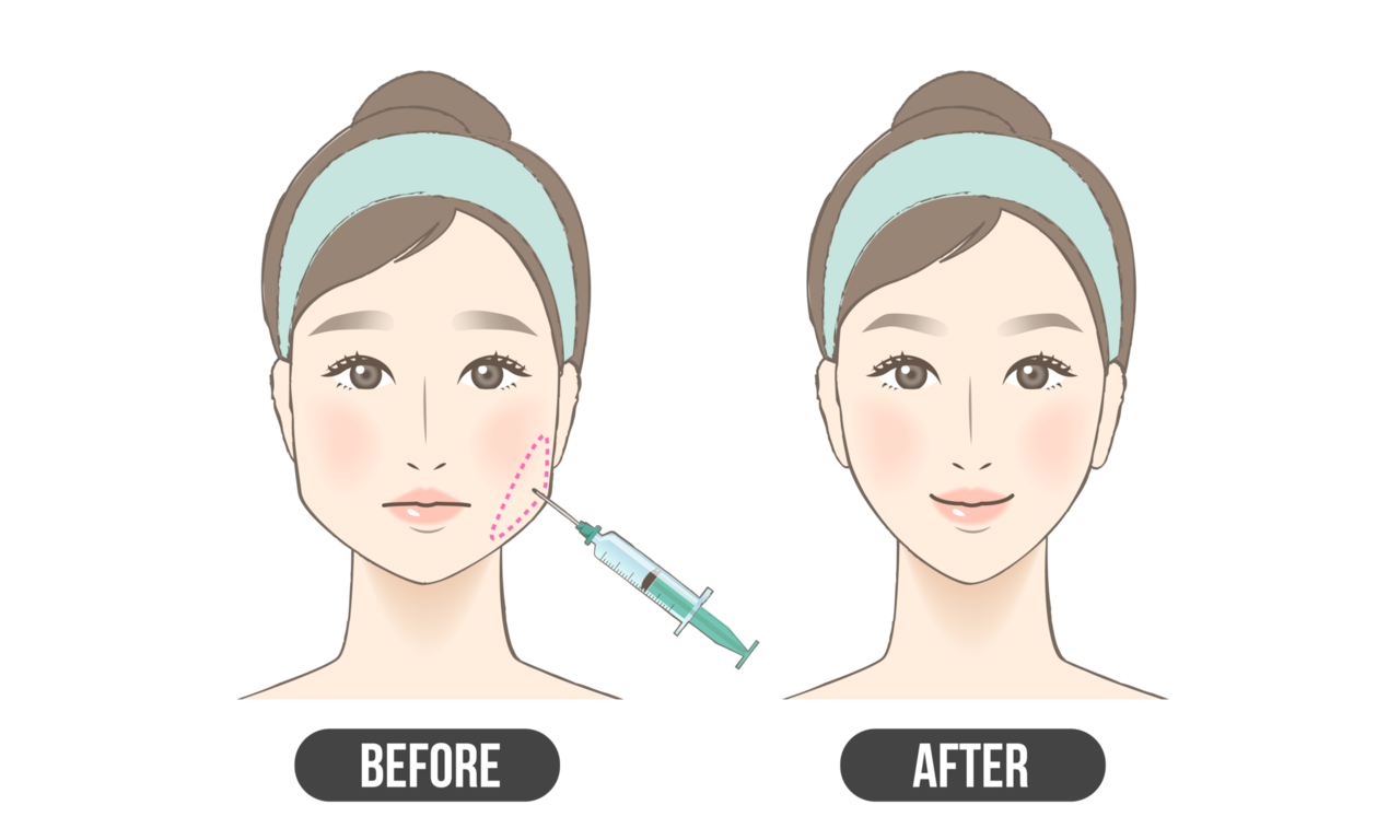 歯や顎のトラブルを予防する“噛む力コントロール”という選択肢