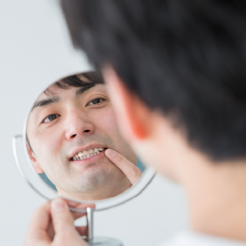 歯の色が気になる方はご相談ください