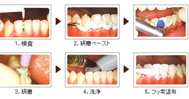 PMTCでお口の中の清潔を保ちます：仁幸会 扇大橋病院歯科の予防歯科