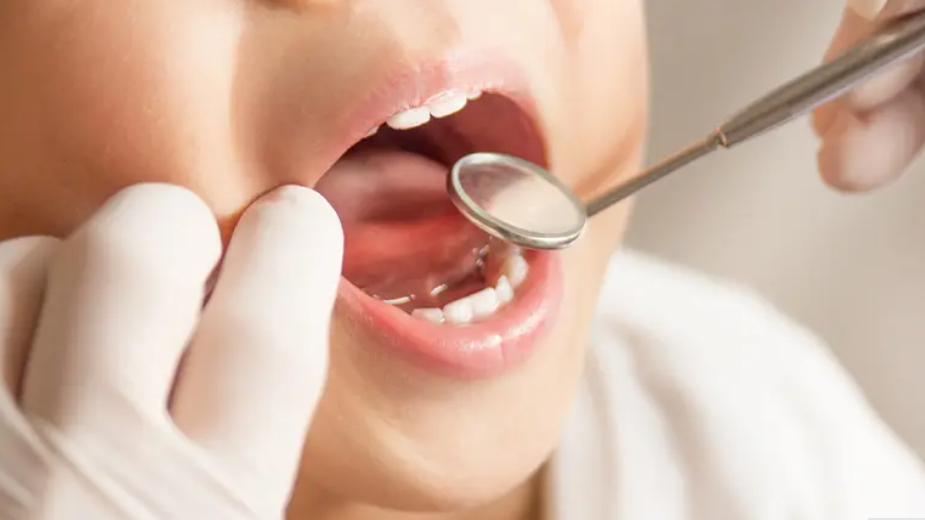 患者様に合わせた予防プランを作成しています