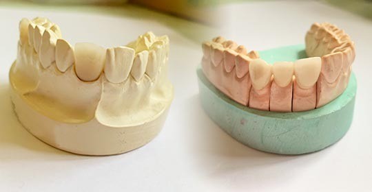 機能と審美の調和を重視した審美歯科治療を提供しています。